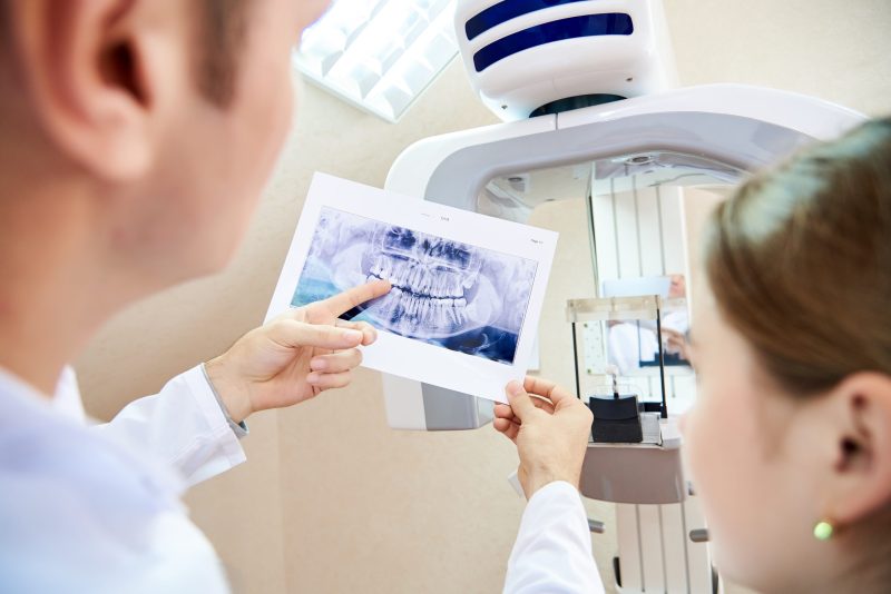 Single-Tooth Dental Implants Silver Spring