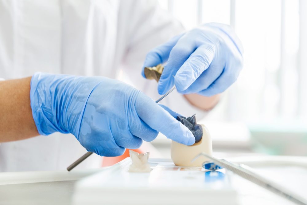 Dental Sealants Silver Spring