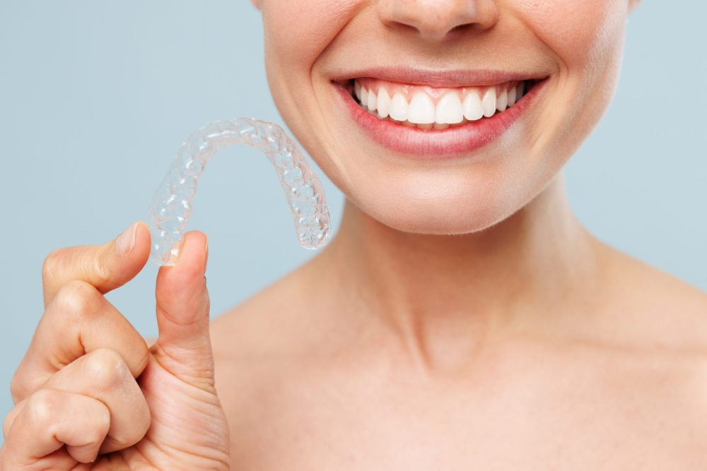 Invisalign Silver Spring