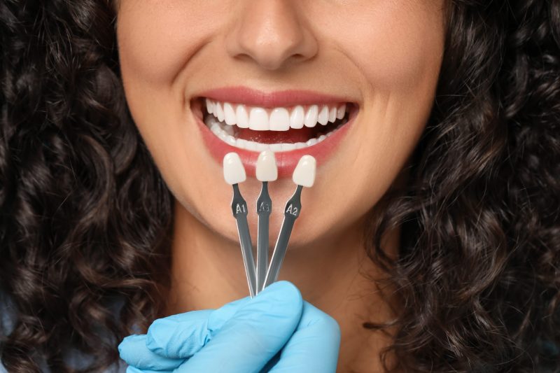 Cosmetic Dentistry Silver Spring
